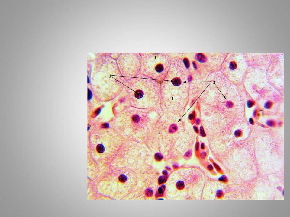 Гепатоциты печени гистология. Клетки печени аксолотля. Гепатоциты гистология препарат. Клетки гепатоциты.