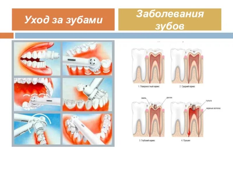 Классификация поражений зубов