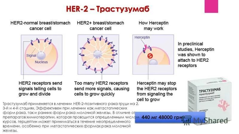 Клетки молочной железы цитология. Выделения из молочных желез при раке. Цитология отделяемого молочной железы. Заболевание с патологическими выделениями желудочного кровотечения. Синдром патологических выделений.