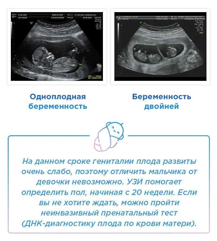 Признаки мальчика при беременности