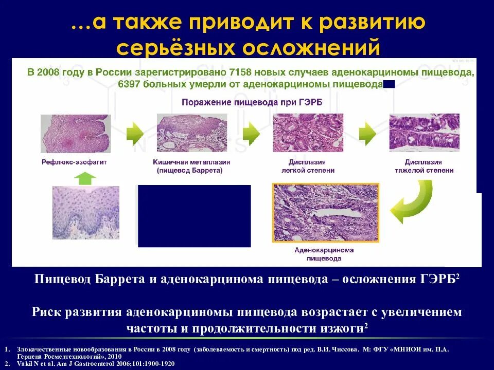 Факторы риска развития ГЭРБ. Аденокарцинома пищевода риск. ГЭРБ степени тяжести. Лос анджелесская классификация эзофагитов