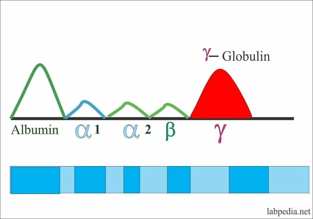 Гамма фракции. Гамма глобулины. альфа 2 глобулины. serum protein electrophoresis. альфа бетта и гамма фракции глобулина.