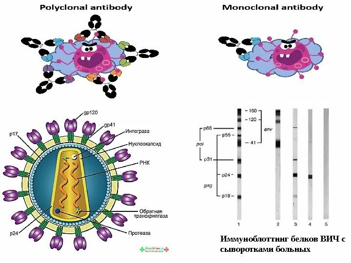 Белки вич. Иммуноблот ВИЧ. Иммунный Блот ВИЧ. Белки ВИЧ инфекции в иммуноблоте. Иммуноблот ВИЧ результат.