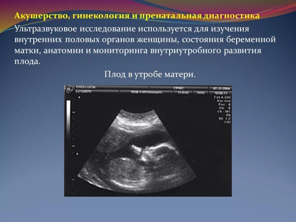 Диагностика развития плода. УЗИ метод пренатальной диагностики. Внутренние исследования УЗИ. А метод УЗИ.