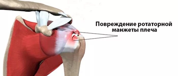Ротаторная манжета плечевого сустава. Мышцы ротаторной манжеты плеча анатомия. Вращательная манжета плечевого сустава анатомия. Ротаторная манжета плеча мышцы. Мышцы ротаторной манжеты плеча.