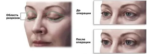 Где находится пластика