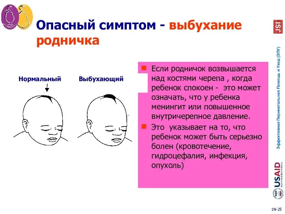 Почему пульсирует родничок