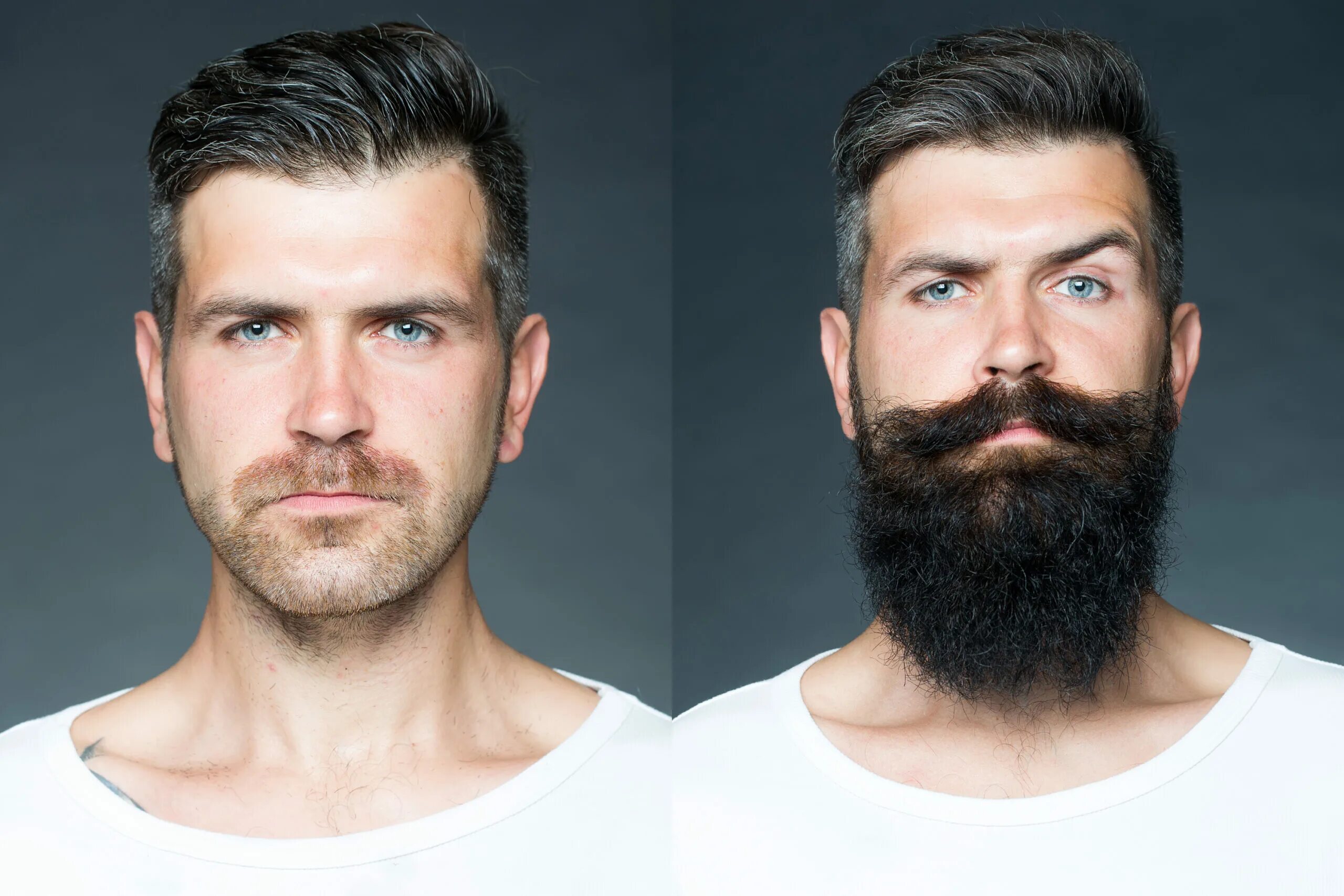 Рост волос на лице у мужчин. Миноксидил narxi. Миноксидил для бороды. Средство для роста бороды миноксидил. Миноксидил для густоты бороды.
