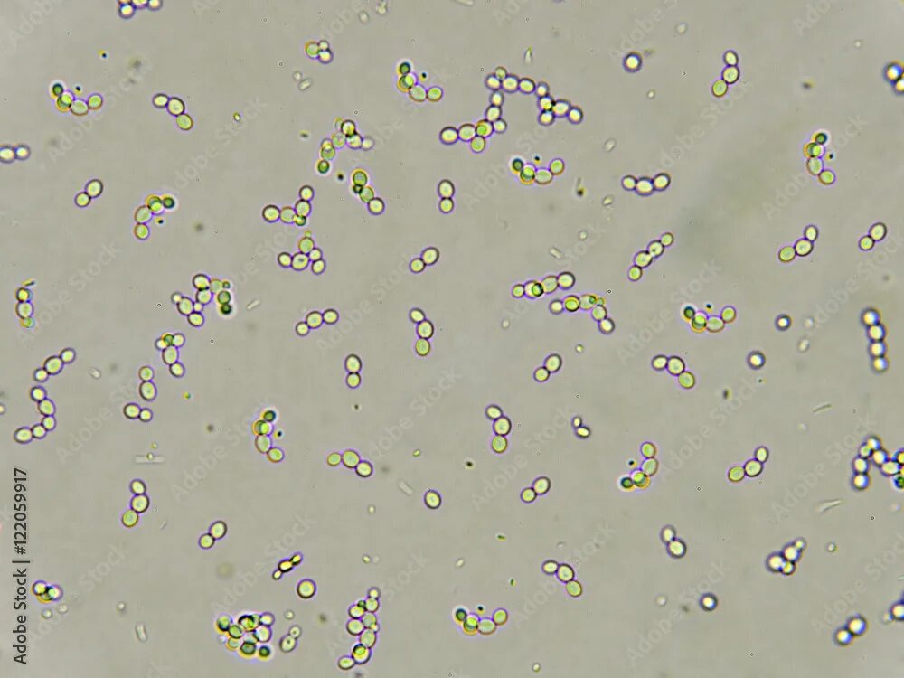 Дрожжевые клетки в моче повышены. Дрожжевые грибы микроскопия мочи. Дрожжи в моче микроскопия. Дрожжи Saccharomyces микроскопия. Мицелий грибов в моче микроскопия.