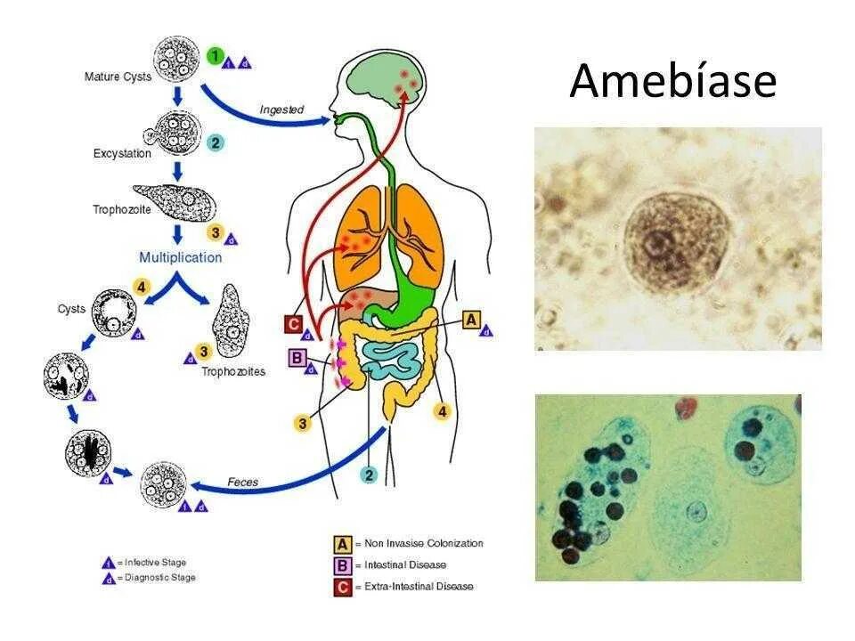 Жизненный цикл дизентерийной амёбы. (Entamoeba histolytica).. Цикл развития дизентерийной амебы. Жизненный цикл дизентерийной амебы схема. Entamoeba histolytica патогенез. Жизненные формы амебы