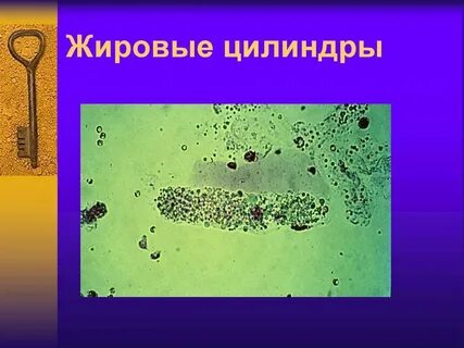 Почечный цилиндр