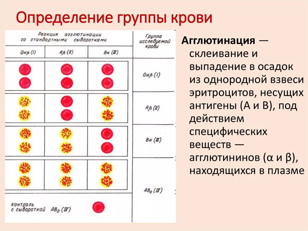 Как определить вторую группу крови. Подгруппы группы крови. Подгруппа 2 группы крови. Подгруппа четвертой группы крови. Какомределить группу крови.