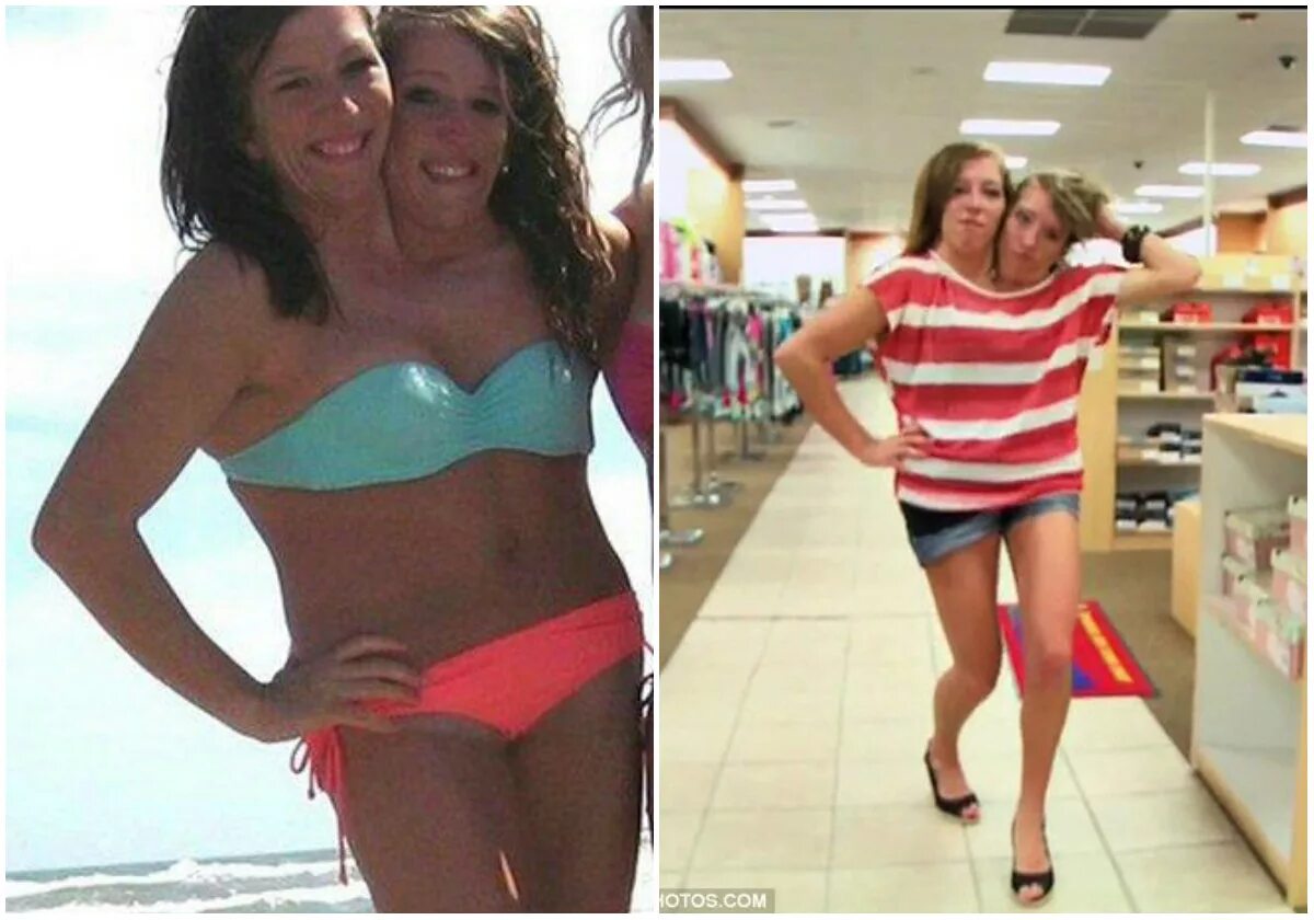 ребекка мартинес сиамские близнецы. эбигейл и британи хенсел. женщина с 3 головами. красивые сиамские близнецы девушки. сёстры эбигейл и бриттани хенсел.