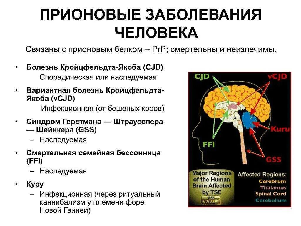 Прионные болезни это. Прионовые болезни. Заболевания вызываемые прионами. Прионы и прионовые заболевания человека. Симптомы прионной болезни.