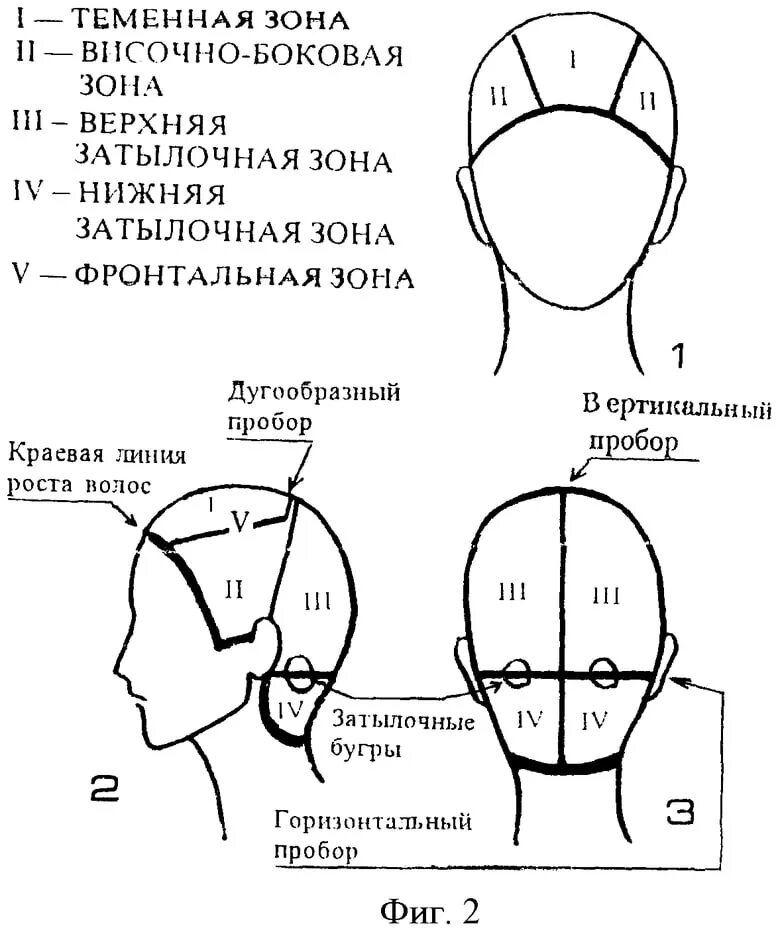 Как называется затылок