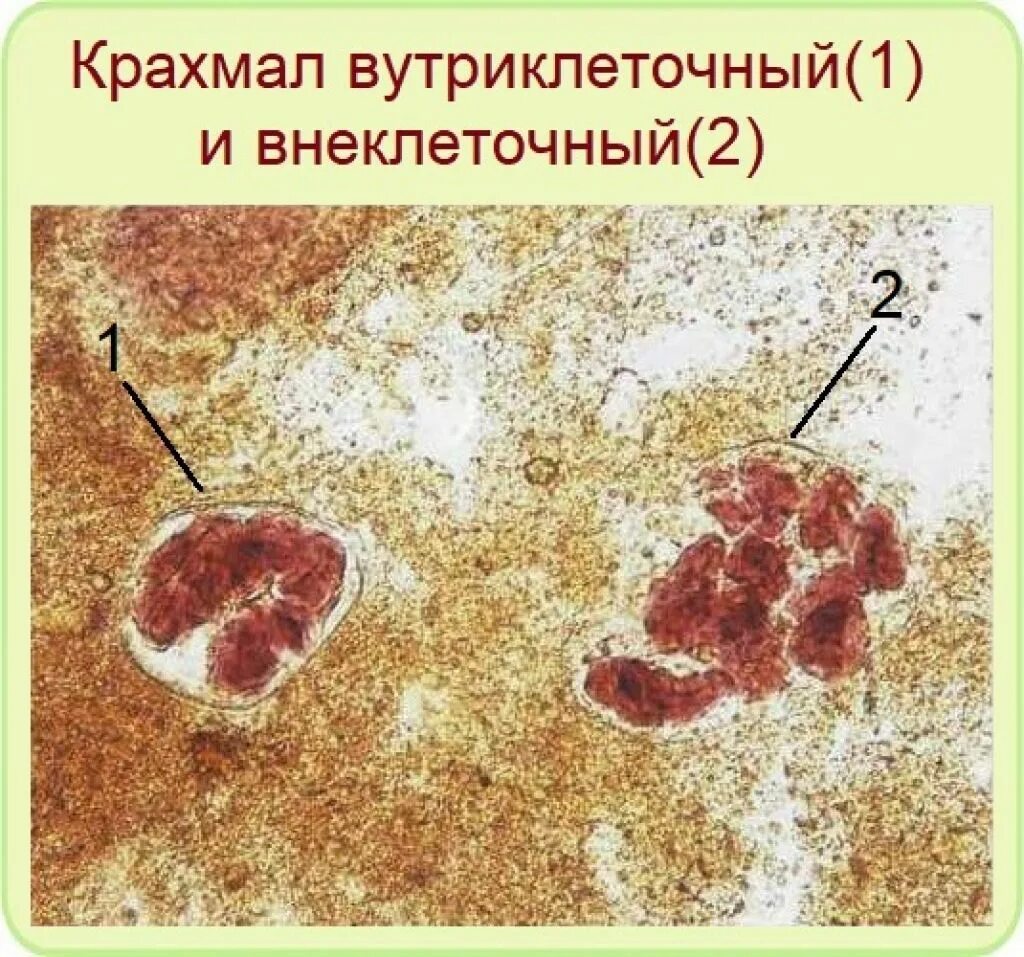 Кальтопроктеин в кале. Копрология кала микроскопия. Микроскопия кала крахмал. Крахмальные зерна в Кале. Зерна крахмала внеклеточные в Кале.