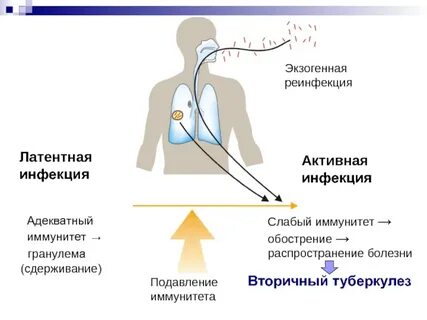 Реинфекция