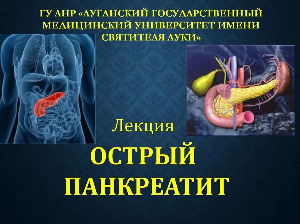 Панкреатит происхождение. Острый и хронический панкреатит лекция. Острый панкреатит лекция. Панкреатит презентация.