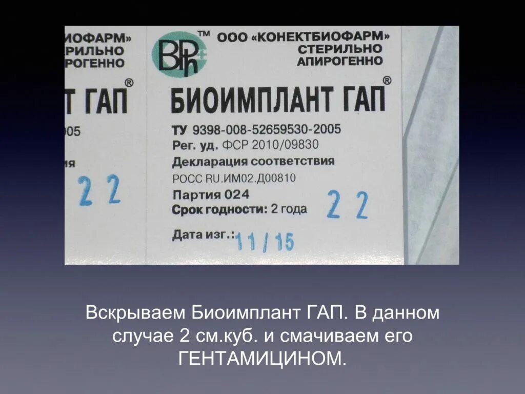 Биоимплант суставов спб. Биоимплант коленного сустава. Биоимплант гап крошка.