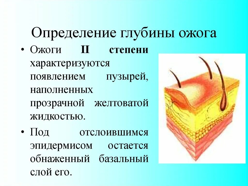 Какая жидкость в ожоге. Ожог 2 степени характеризуется. Вторая степень ожога характеризуется. Определение глубины ожогов.