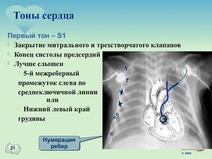 Тоны клапанов