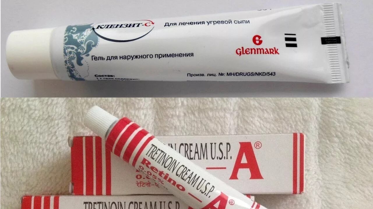 Как избавиться от веснушек на лице навсегда. Крем избавляющий от веснушек. мазь для веснушки. как удалить веснушки навсегда. как можно убрать веснушки с лица.