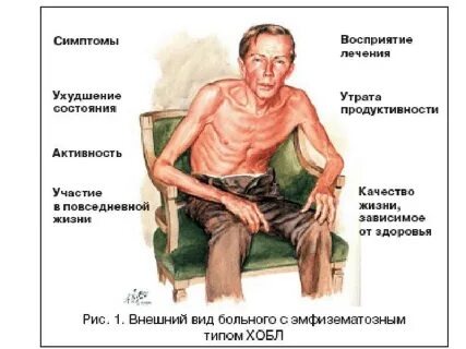 Остались болезнь