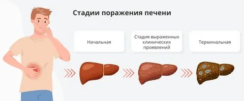 Признаки боли печени у мужчин симптомы