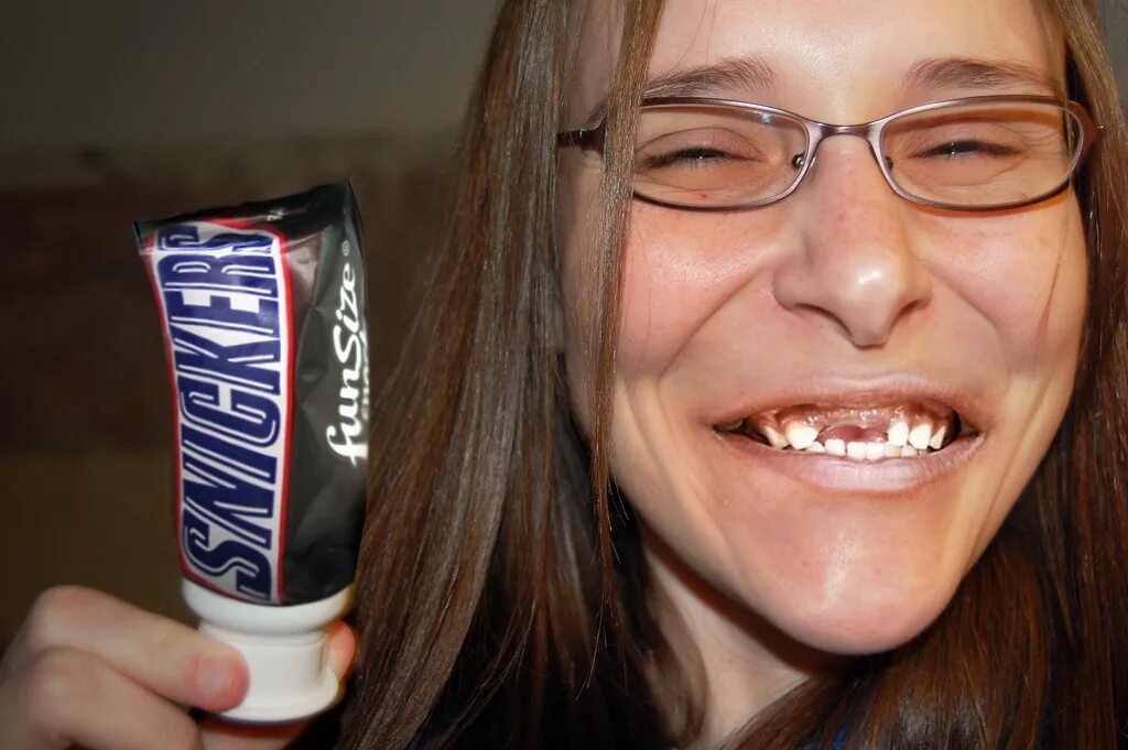 Улыбка с брекетами. Профессиональная чистка зубов. Профилактика зубов инфографика. Железная пластина для зубов. Зубы после тотема.