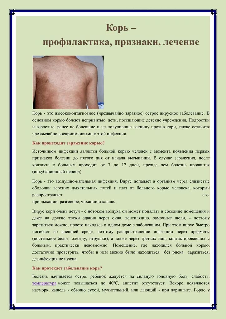 Как проявляется корь. Симптомы корь симптомы.