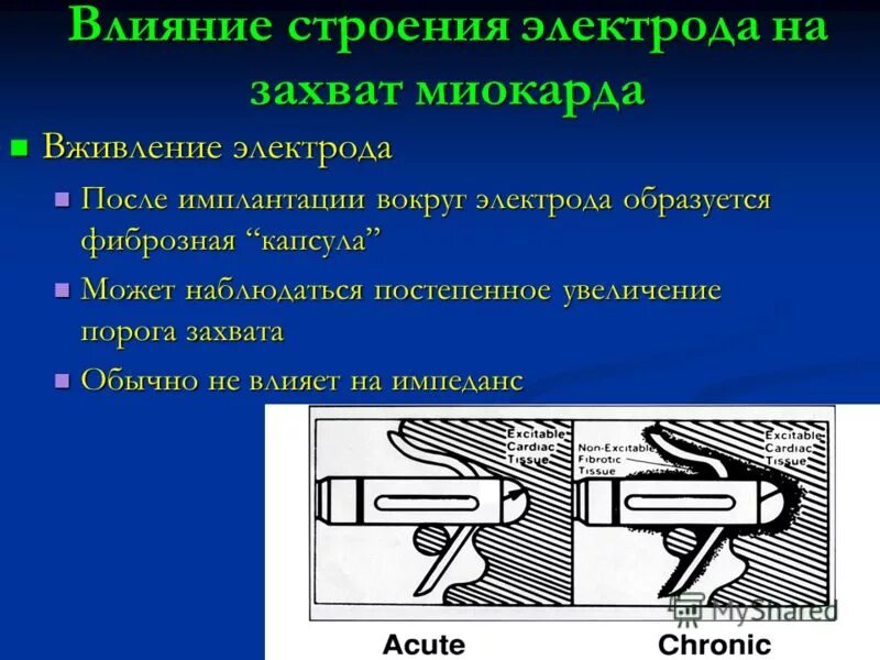 Строение электрода. Импеданс электрода. Импеданс электрода кардиостимулятора. Электроды кардиостимулятора.