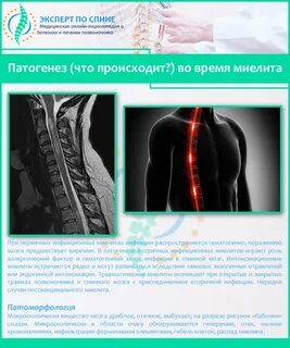 Острый поперечный миелит