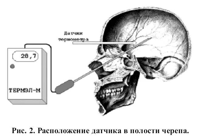 Сообщения полостей черепа. Полости черепа для голоса резонаторы. Попадания воздуха в полость черепа. Полости черепа для сброса давления. В полости черепа расположен