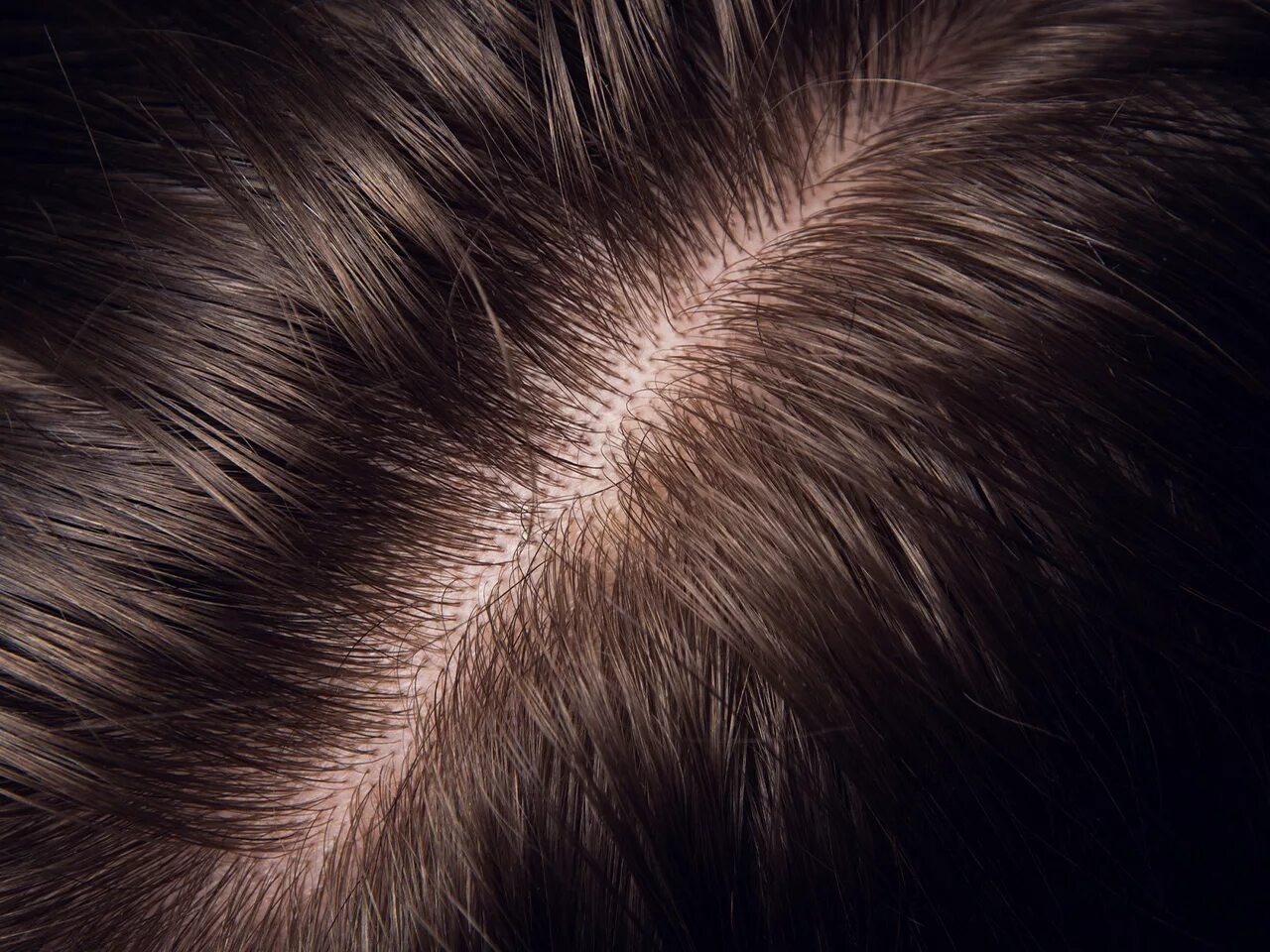 Healthy scalp