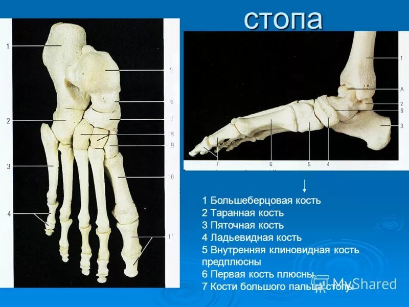 Фото стопы человека с названием. Кости стопы анатомия. Таранная кость стопы анатомия. Кости плюсны и предплюсны. Клиновидная кость стопы анатомия.