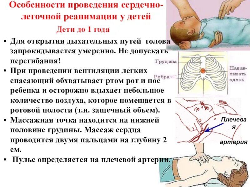 Искусственное дыхание сколько вдохов надавливаний. Непрямой массаж сердца алгоритм действий детям. Сердечно легочная реанимация у детей до 8 лет. Сердечно-лёгочная реанимация (СЛР) У детей.