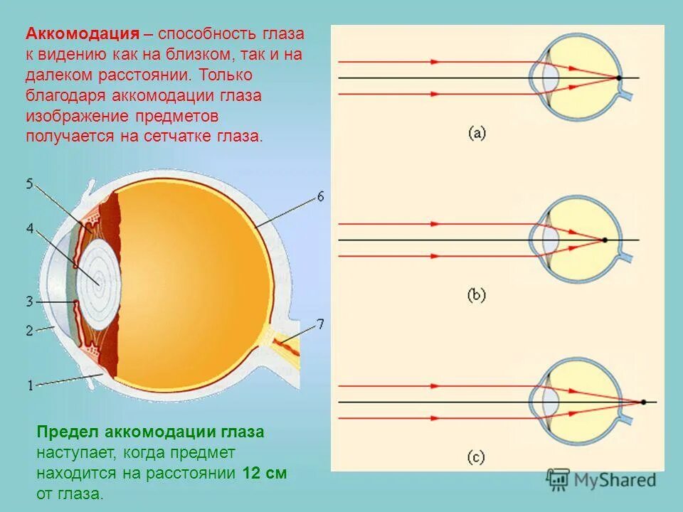 Какая структура обеспечивает аккомодацию. Механизм аккомодации хрусталика. Аккомодация хрусталика глаза. Состояние покоя аккомодации фокус. Состояние покоя аккомодации фокус на сетчатке.