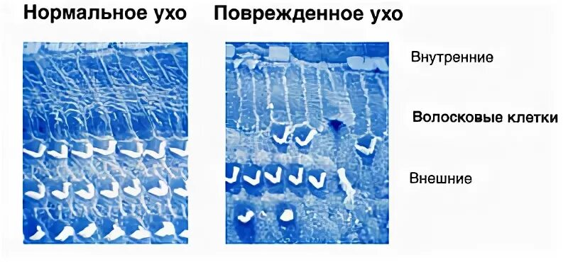 Наружные и внутренние волосковые клетки. Волосковые клетки внутреннего уха человека. Волосковые клетки уха. Волосковые клетки уха человека. Чувствительные клетки внутреннего уха