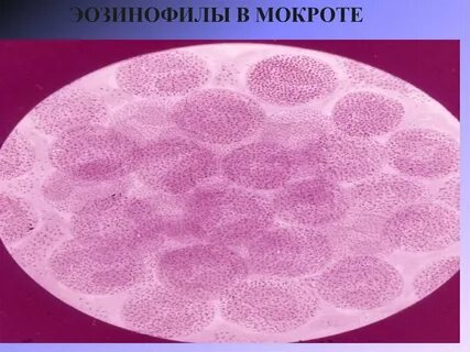 Мокрота мазок