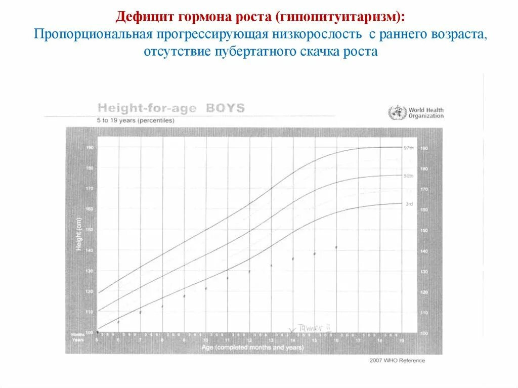 Гормон роста пробы. Недостаточность гормона роста. Низкорослость дефицит гормонов. Рост при низкорослость. Дефицит гормона роста при гипопитуитаризме.