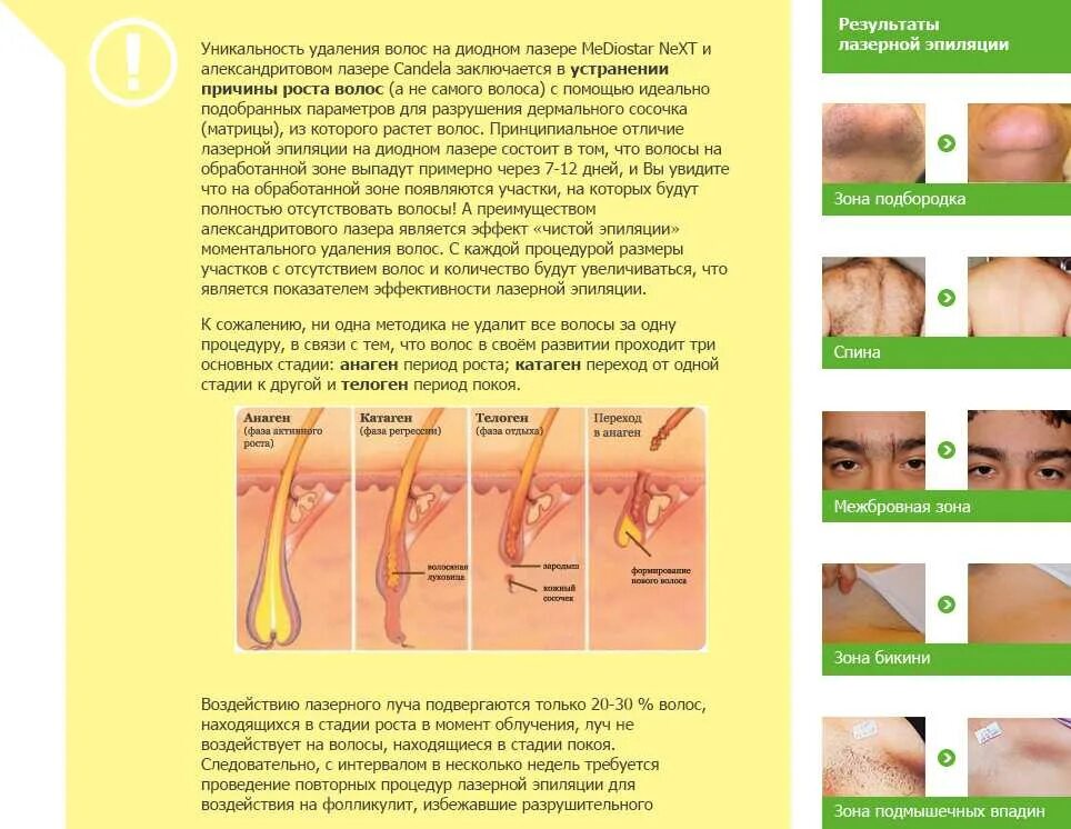 Сколько процедур лазерной эпиляции нужно для бикини. Электроэпиляция результат после первой процедуры. Схема депиляции подмышек воском. Лазерная эпиляция процедура волос. Популярные методы депиляции.