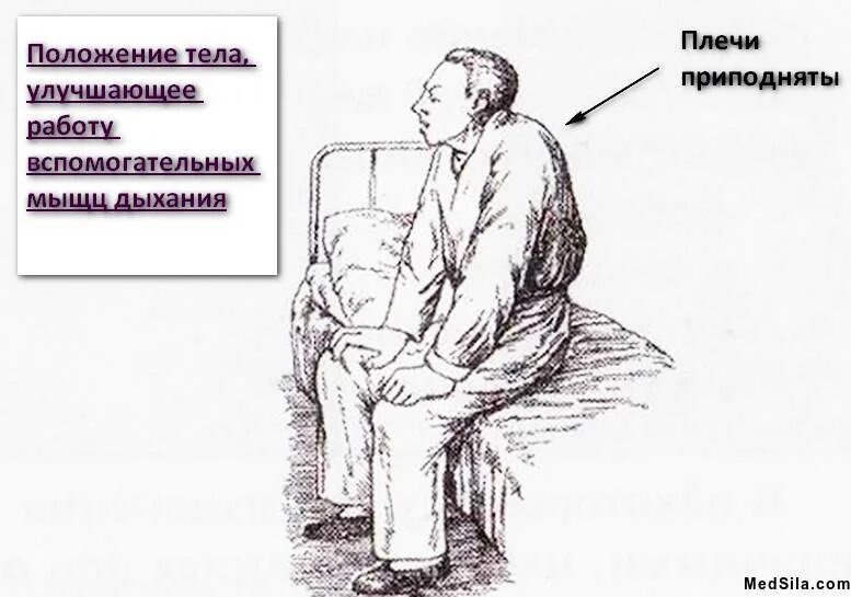 Положение во время приступа бронхиальной астмы. Поза ортопноэ при бронхиальной астме. бронхиальная астма положение ортопноэ. положение ортопноэ при бронхиальной астме. вынужденное положение при приступе бронхиальной астмы.