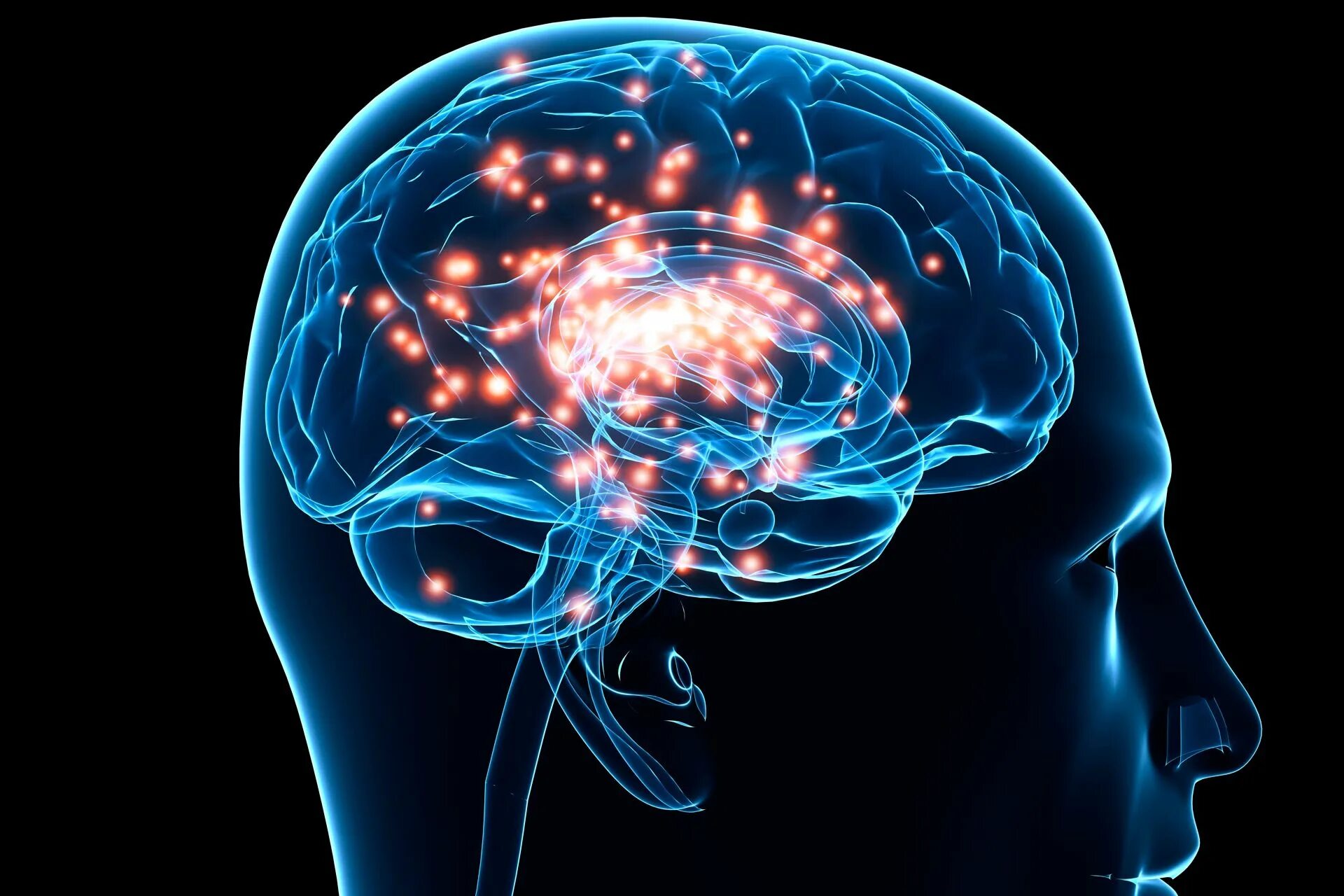 Brain injury. Телепатия мозг. Вживление электродов в мозг. Сакральная нейромодуляция. Нейростимуляция.