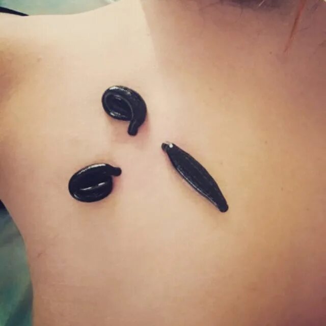 гирудотерапия иркутск