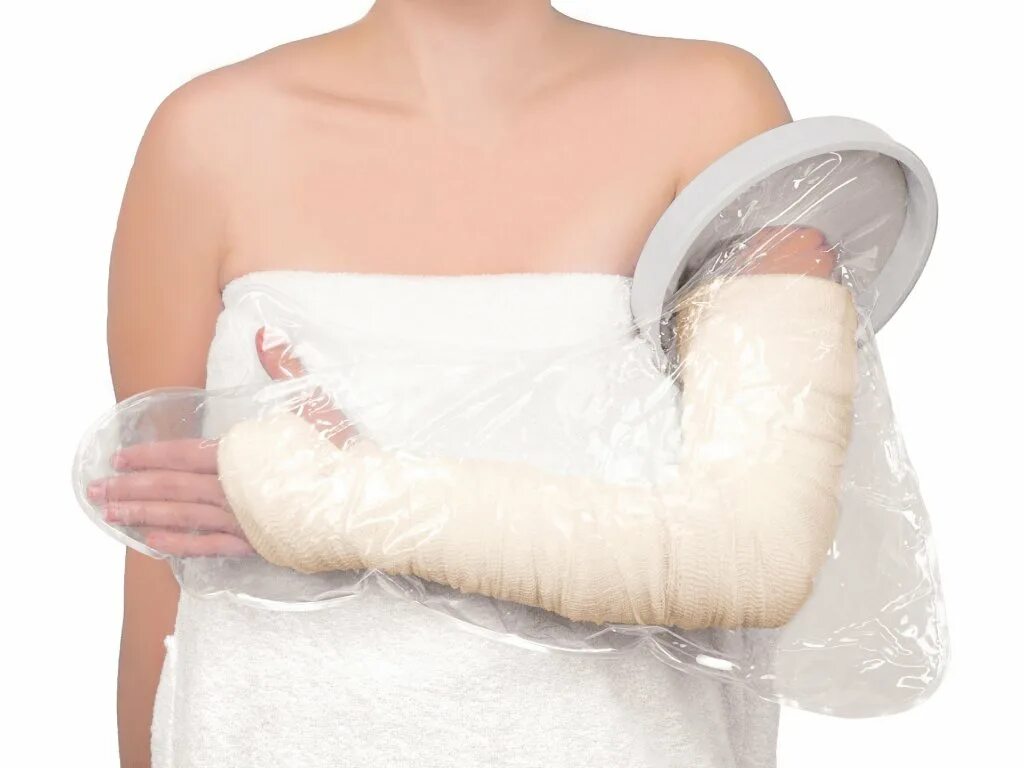 Можно ли мыть гипс. Защитный чехол на гипс для руки. Можно ли мыть гипс. Полимерный гипс. Полимерный гипс на руку.