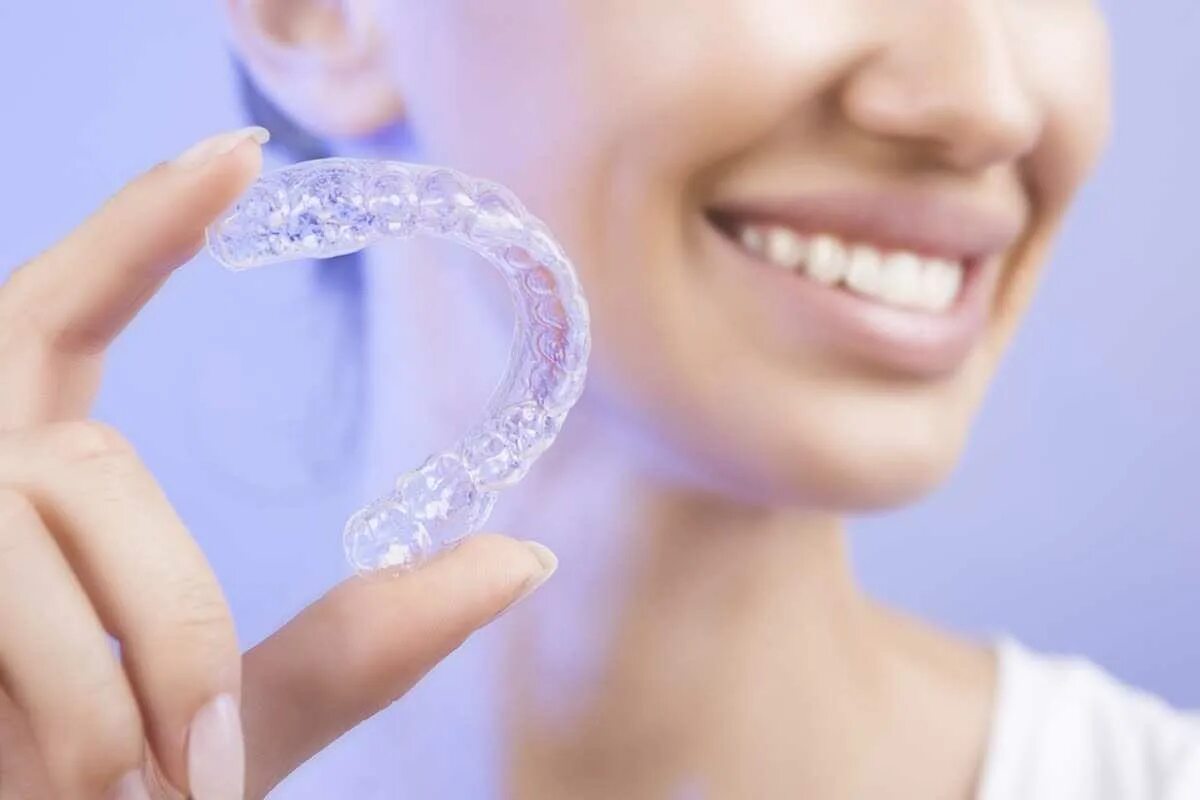 Элайнеры это. Элайнеры инвизилайн. элайнеры invisalign. элайнеры star smile. элайнеров invisalign.