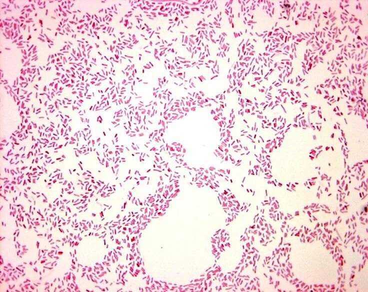 Microscopic photography, Microbiology, Bacteria under microscope