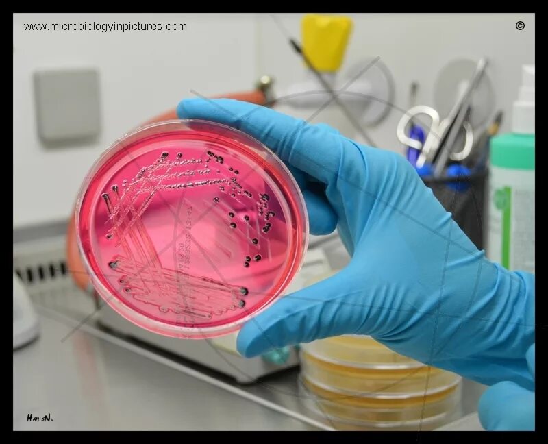 Посев на сальмонеллез. Сальмонелла микроскопирование. Сальмонелла на xld агаре. Среда эндо в чашках петри. Сальмонелла на эндо.