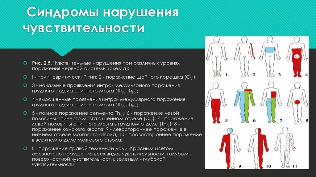 Типы нарушений чувствительности: синдромы. Типы расстройств чувствительности неврология. Чувствительная система синдромы симптомы поражения. Периферический Тип расстройства чувствительности.