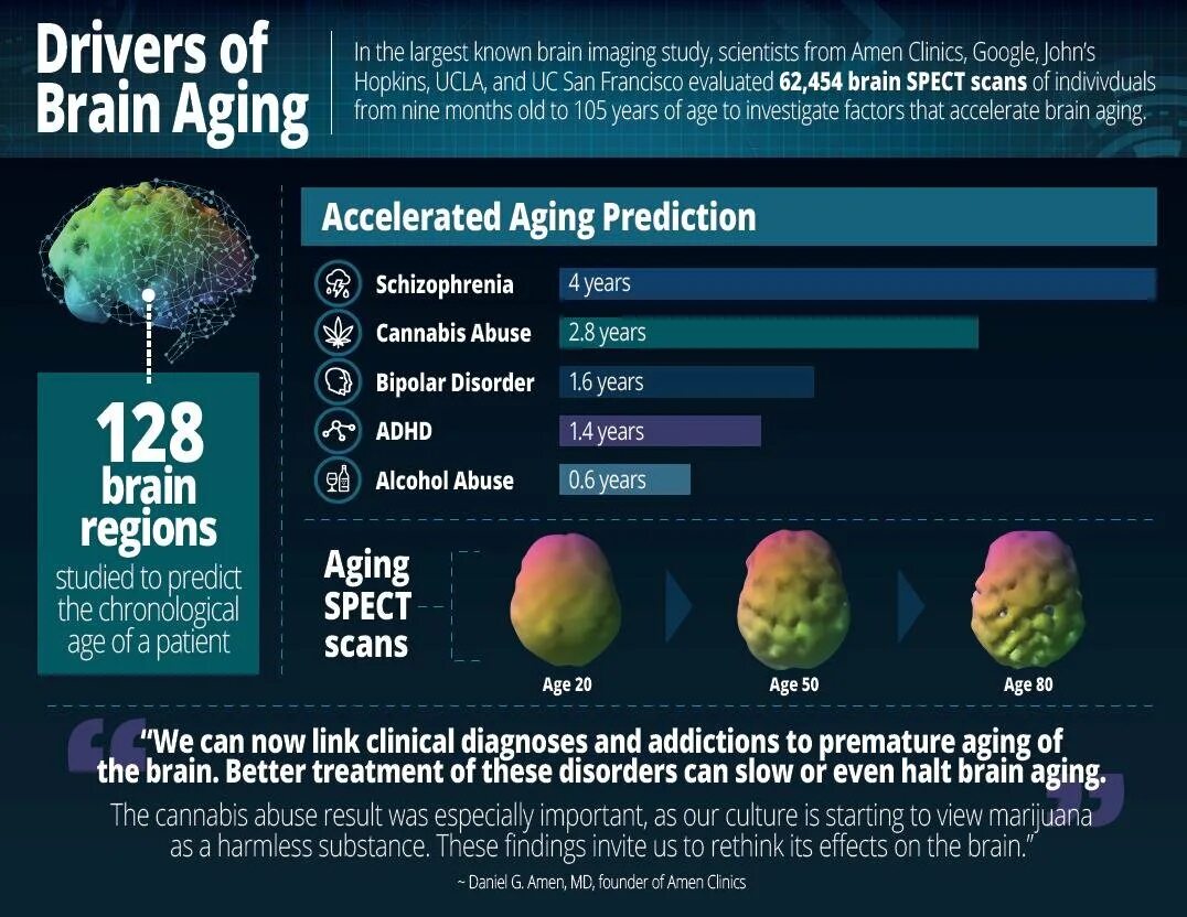 Brain age. Aging Brain. Effects of marijuana on the teenage Brain. SPECT Brain scan Results.